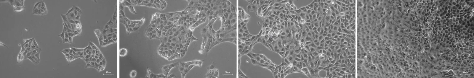 Cell microscopy images at different confluence levels